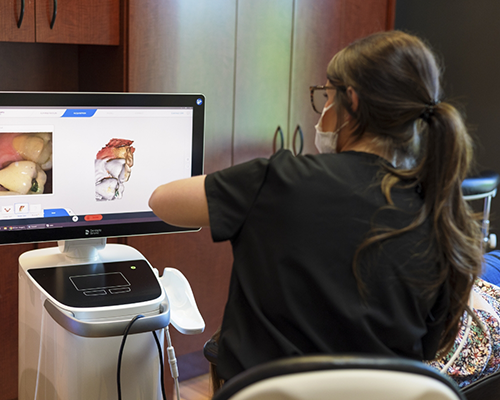 Digital Impression System