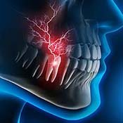 Diagram of a person with severe tooth pain in Louisville