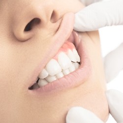 examining patient’s gums