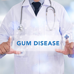 dentist framing the words gum disease