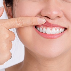 Woman pointing to her gums