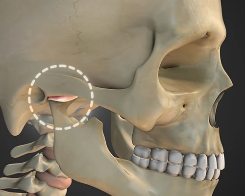 Equilibration/Occlusal Adjustment